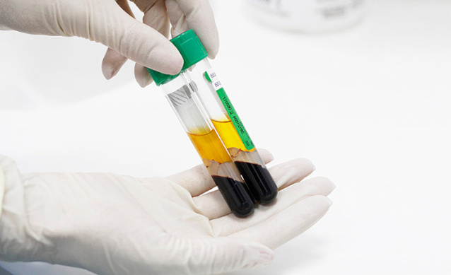 Кровь для плазмолифтинга