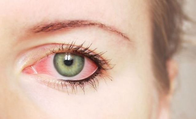 Красные глаза